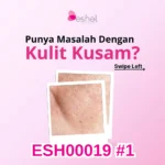 thumb 1 -- ESH00019 Dignissim Congue